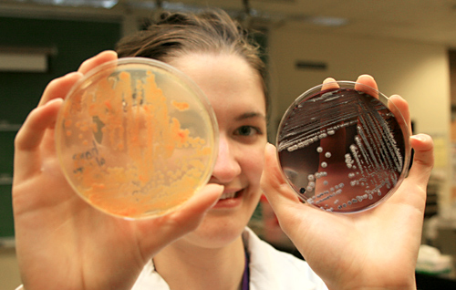 Devon holds up two plates of bacteria scraped from the nearby Helmcken Caves during a photo shoot in a lab at Thompson Rivers University on July 30, 2010.